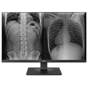 LG 27HJ713C-B – Monitor Clínico 27" IPS 8MP 4K DICOM
